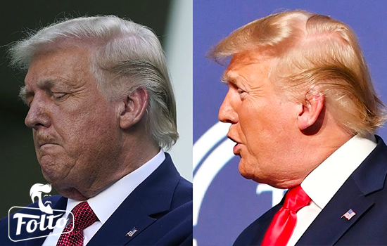 Colore dei capelli di Donald Trump